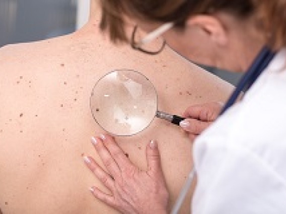 Caucasian with freckles undergoing skin cancer screening by Caucasian doctor with magnifying glass