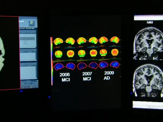 images of brain scans