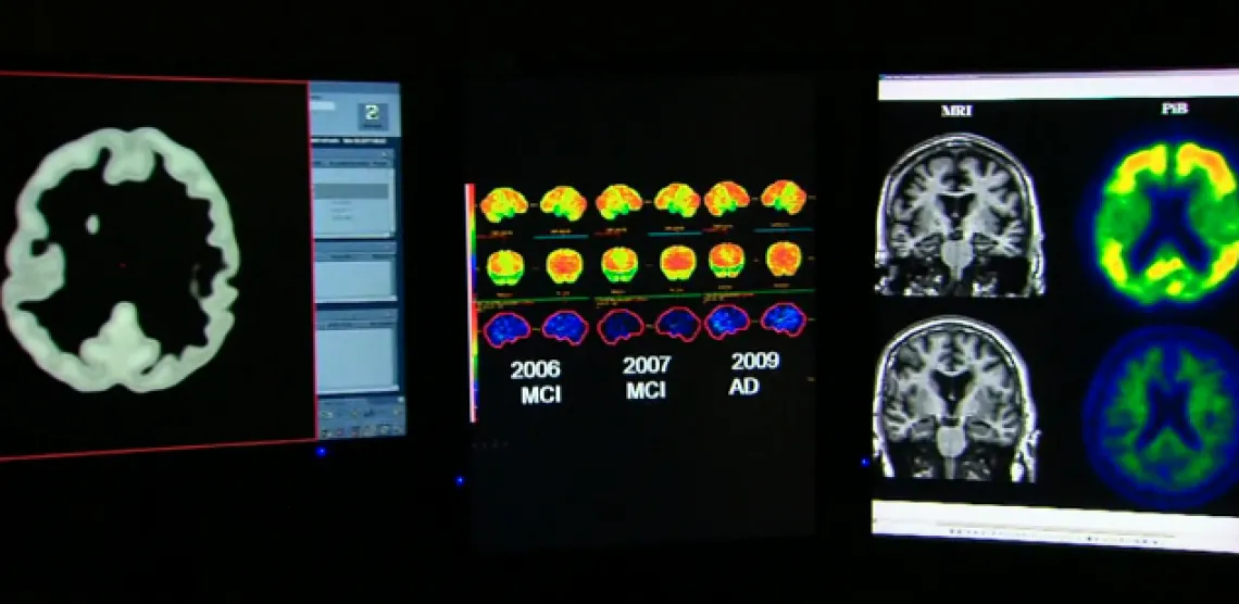 images of brain scans