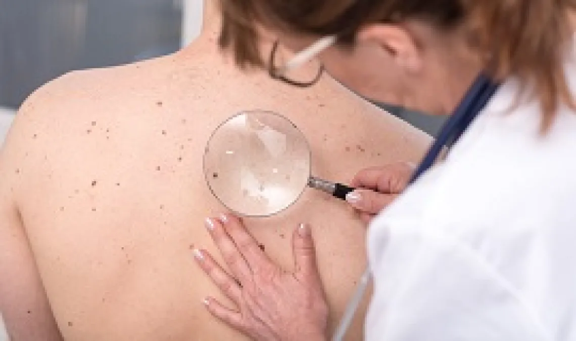 Caucasian with freckles undergoing skin cancer screening by Caucasian doctor with magnifying glass